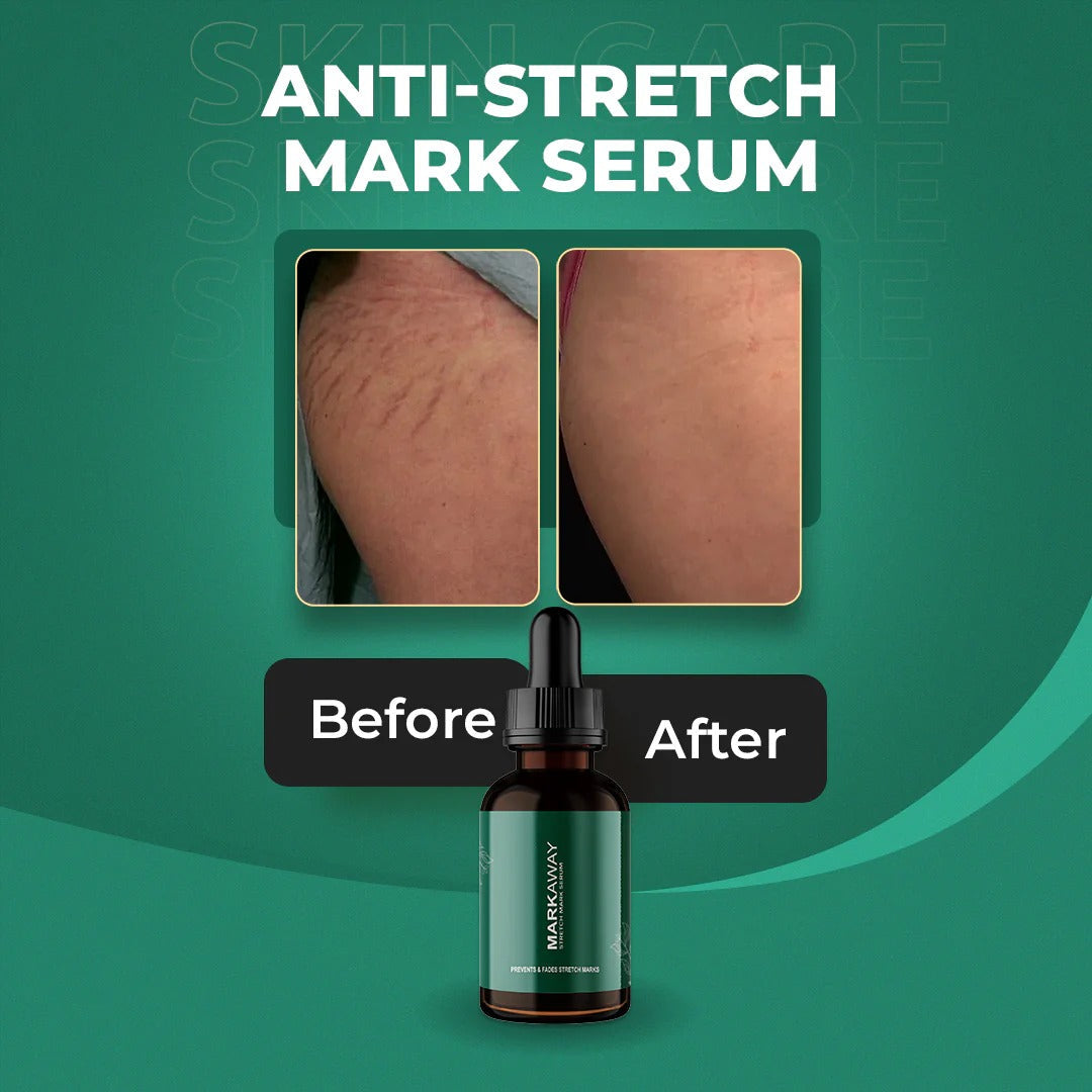 Markaway Stretch Mark Serum
